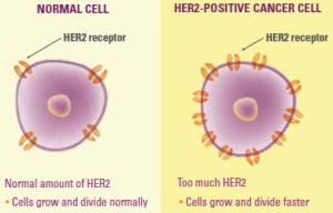 HER2 positive breast cancer | Breastlink